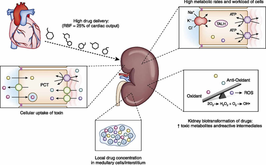 Nephrotoxicity Definition, Causes, Nephrotoxicity Drugs, Signs & Symptoms