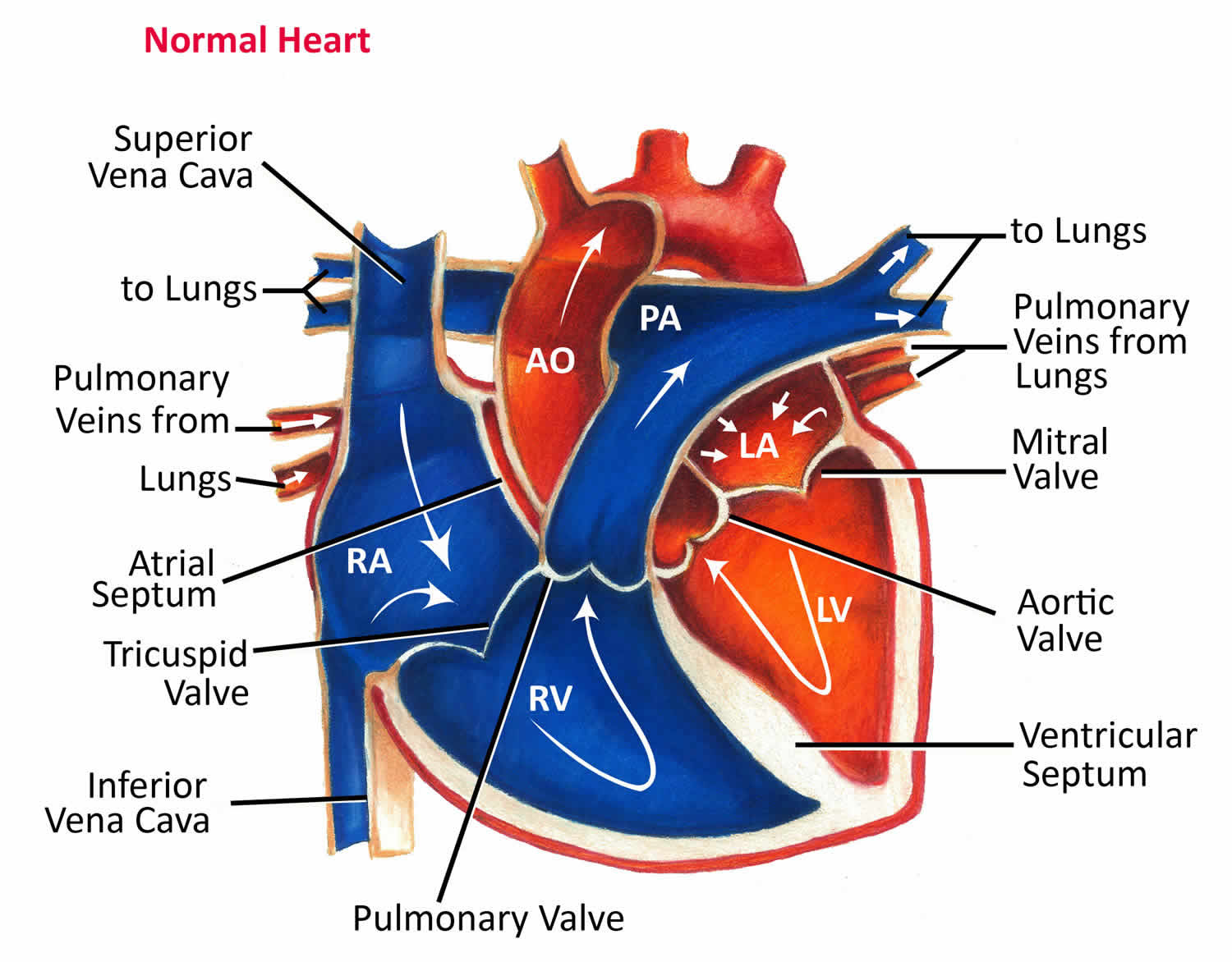 Right ventricular hypertrophy causes, symptoms, diagnosis, ECG ...