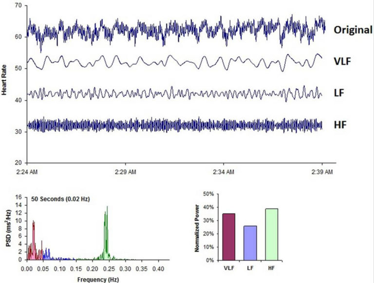 Heart Rate Variability Definition Control Mechnisms And Measurement