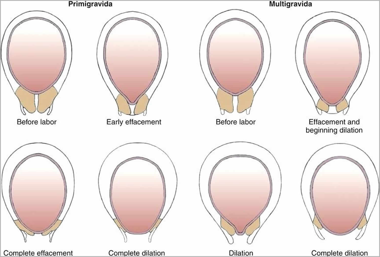 cervix opening during labor