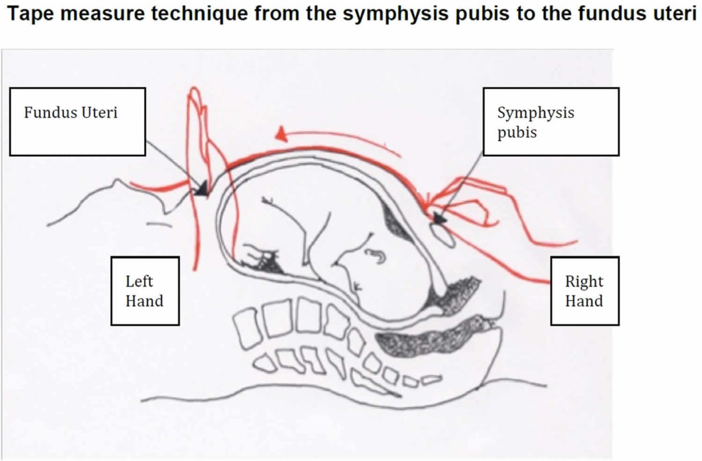 fundal-height-fundal-height-measurement