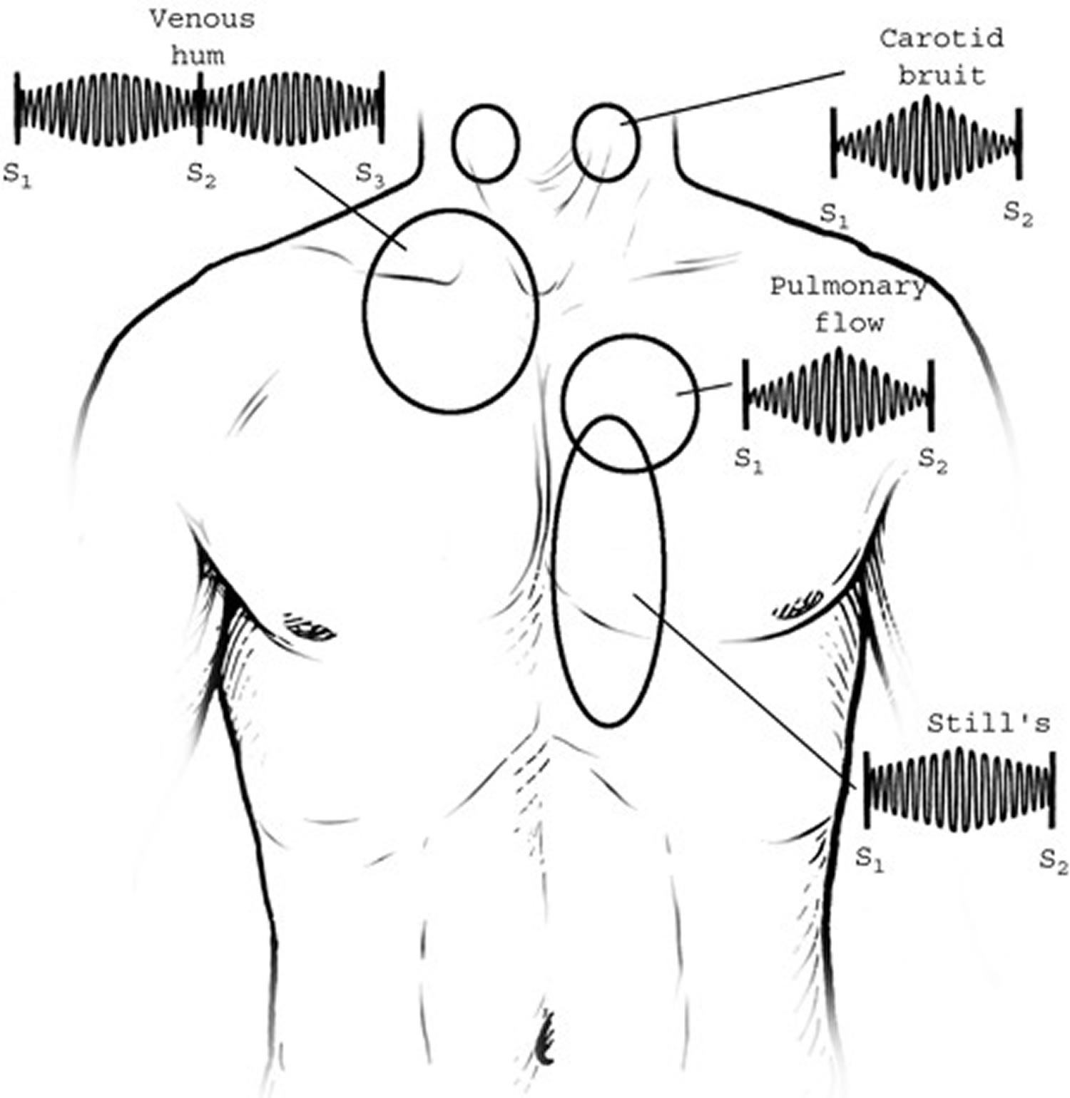 Omega 3 Heart Murmur at James Copeland blog