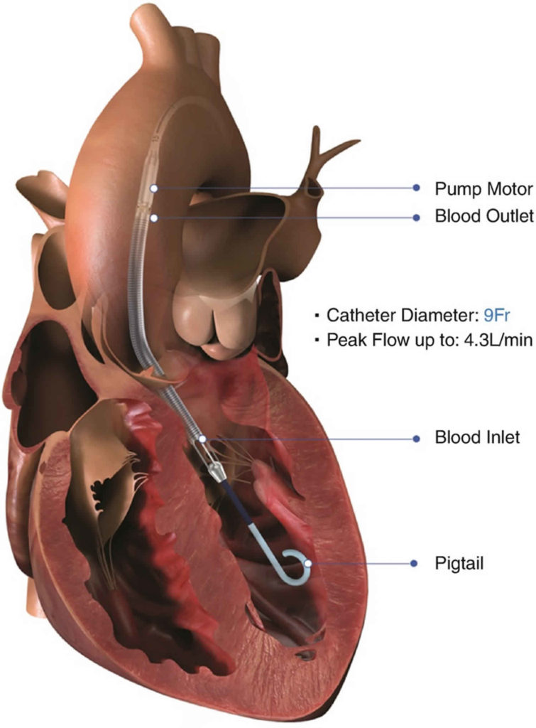 Impella ventricular assist device