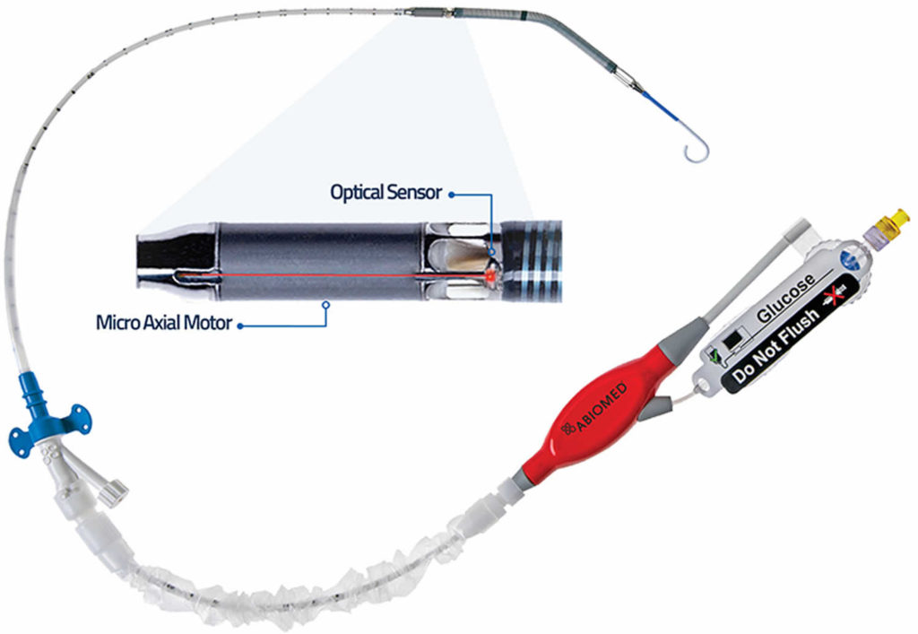 Impella ventricular assist device