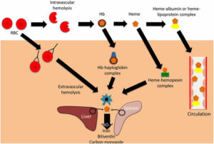 Intravascular Haemolysis Causes, Symptoms, Diagnosis & Treatment