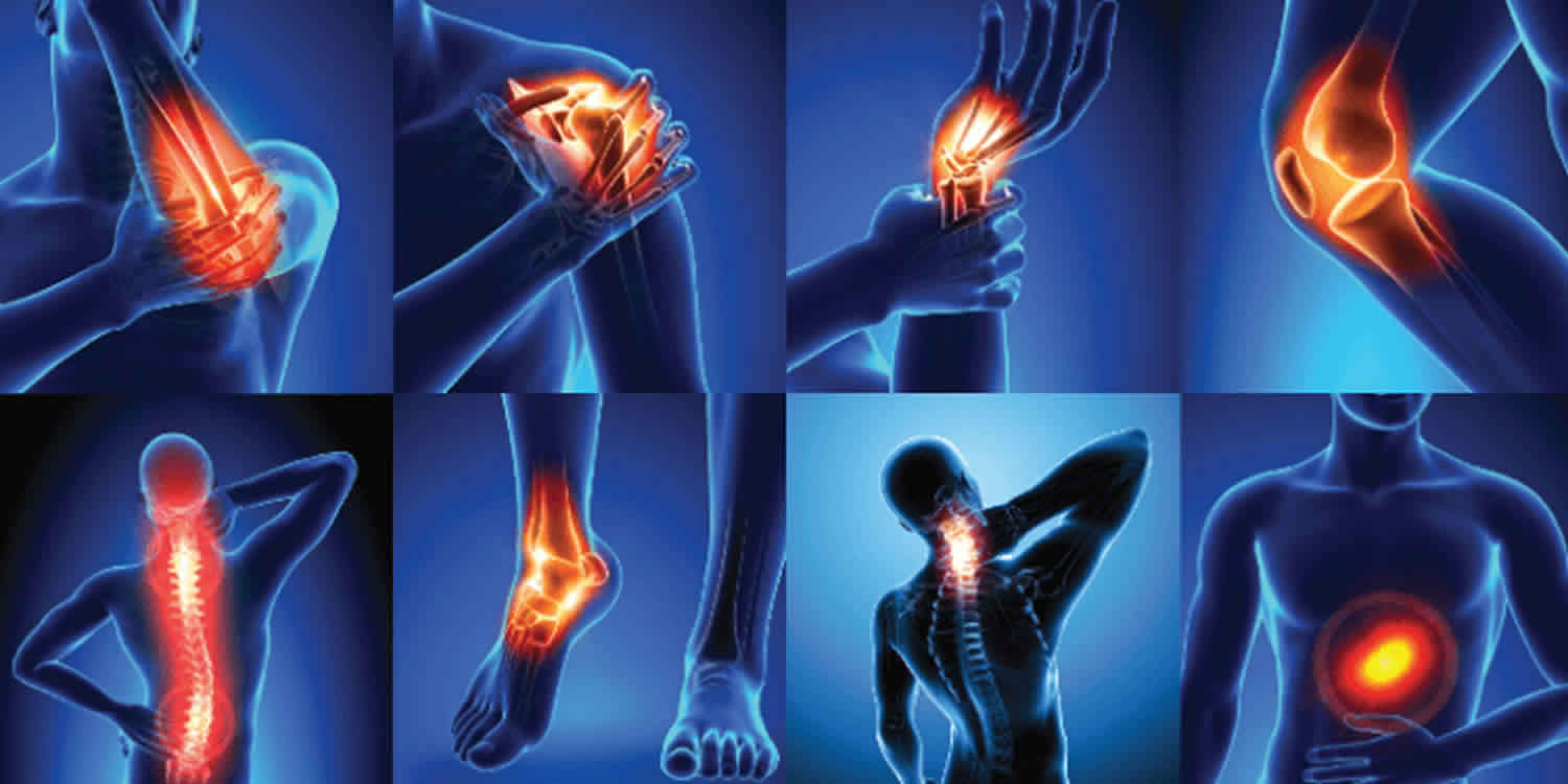 Can Arthritis Cause Your Whole Body To Ache at Dorothy Brooks blog