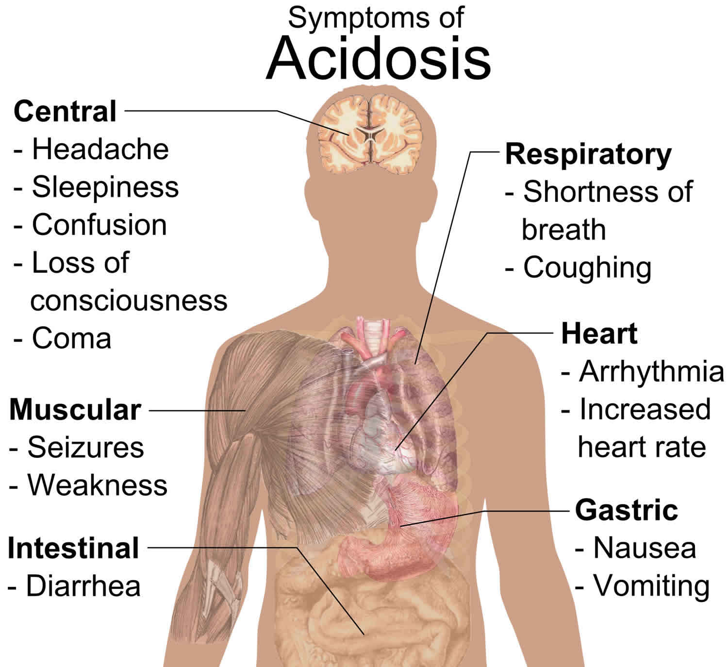 normal-anion-gap-metabolic-acidosis-or-non-anion-gap-metabolic-acidosis