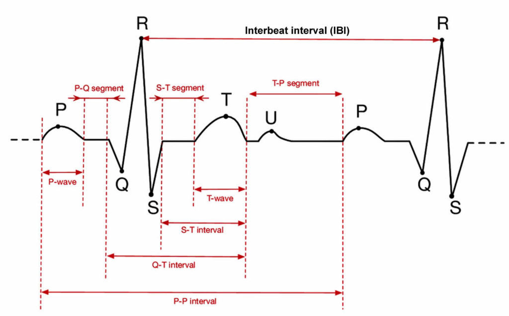 Sinus rhythm, normal sinus rhythm & sick sinus rhythm