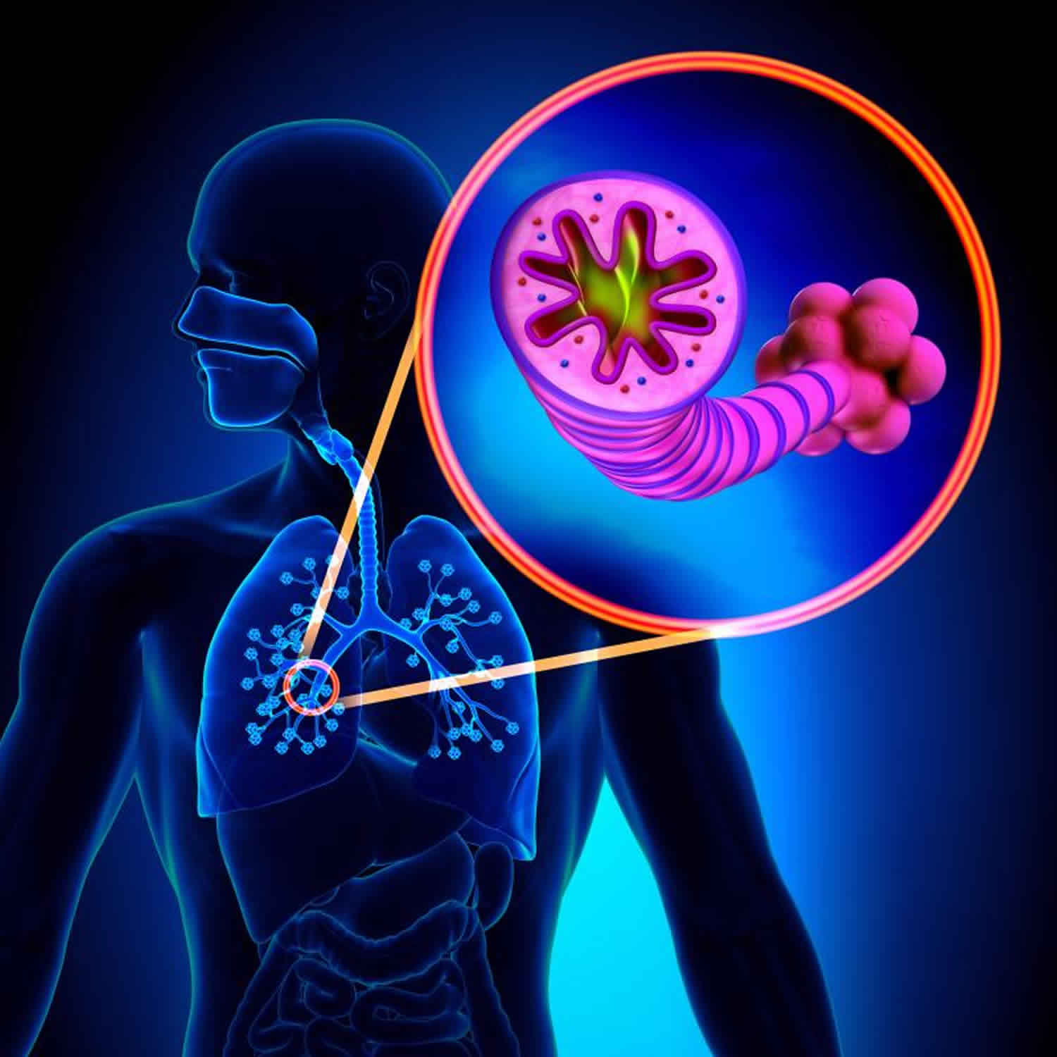 overlap-syndrome-asthma-copd-overlap-syndrome