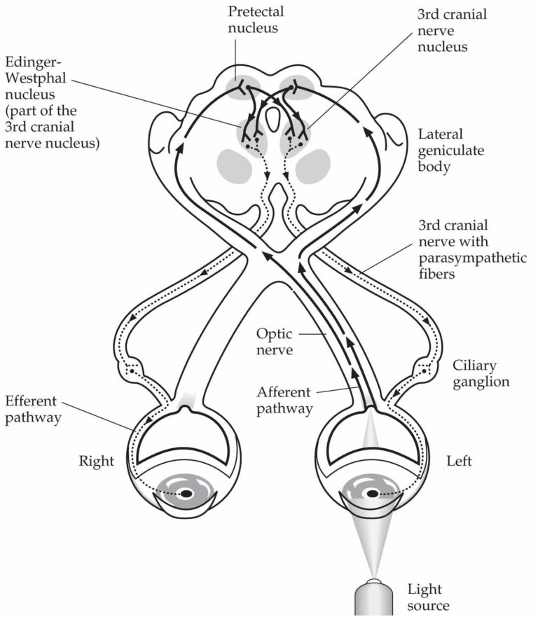 Pupillary light reflex & pupillary light reflex test