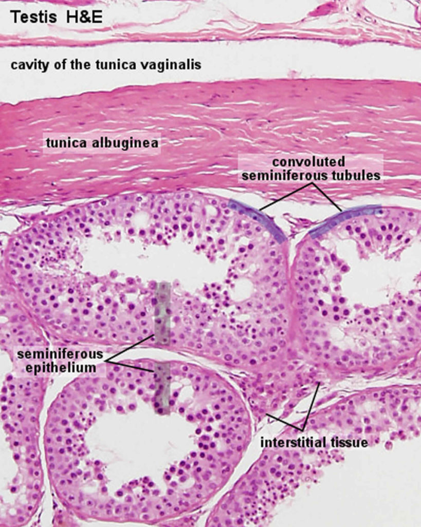 Sertoli cell only syndrome causes, symptoms, diagnosis, treatment ...