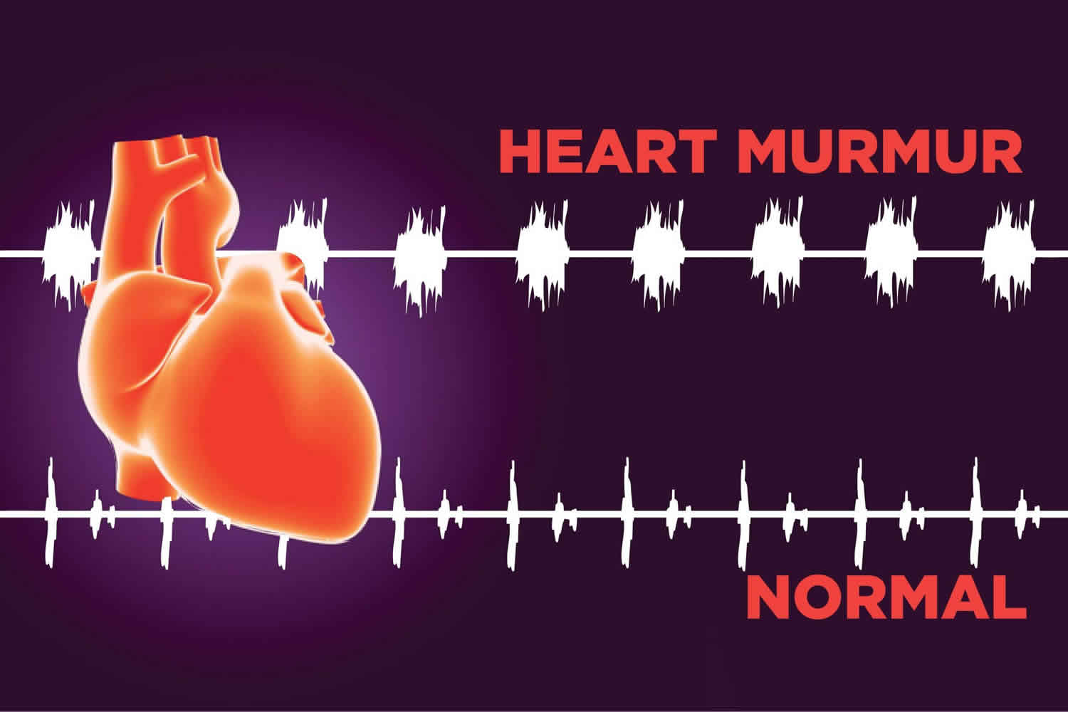 heart-murmur-pictures