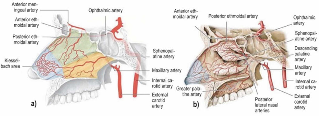 Septal hematoma causes, symptoms, diagnosis & treatment