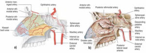 Nose cauterization for nose bleeds, nose cauterization side effects