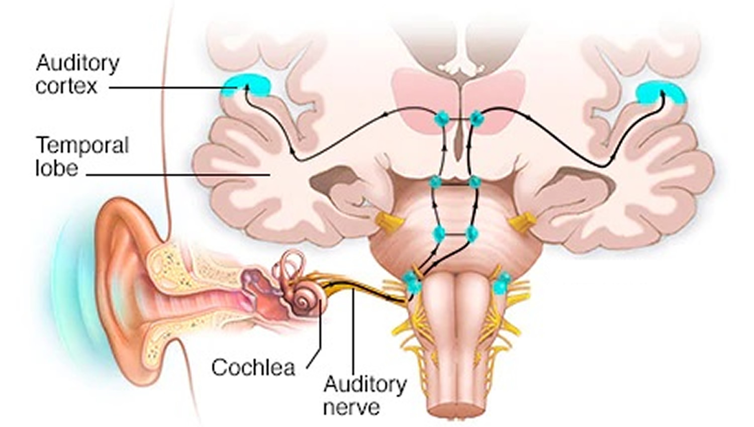 auditory cortex located