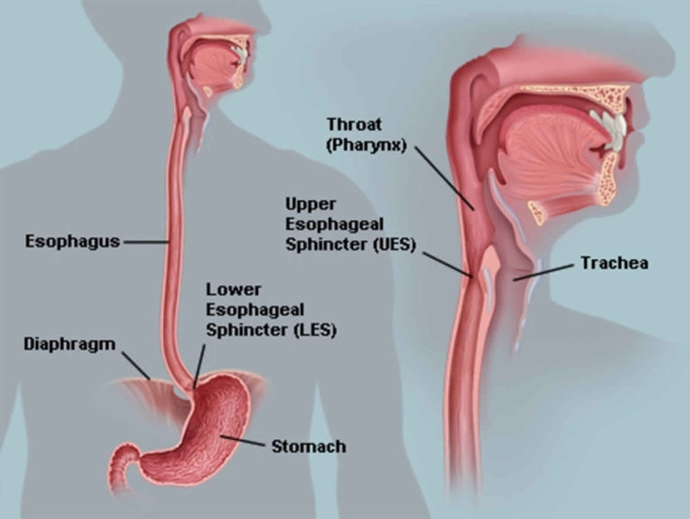 Esophageal dysmotility, esophageal motility disorder, causes, symptoms