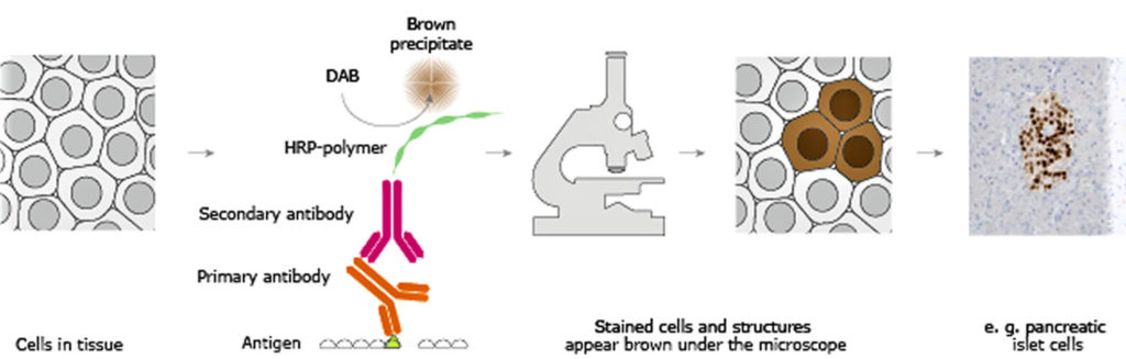 Immunohistochemistry, Immunohistochemistry Technique & Clinical ...