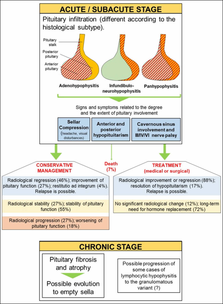 Hypophysitis causes, symptoms, diagnosis & treatment