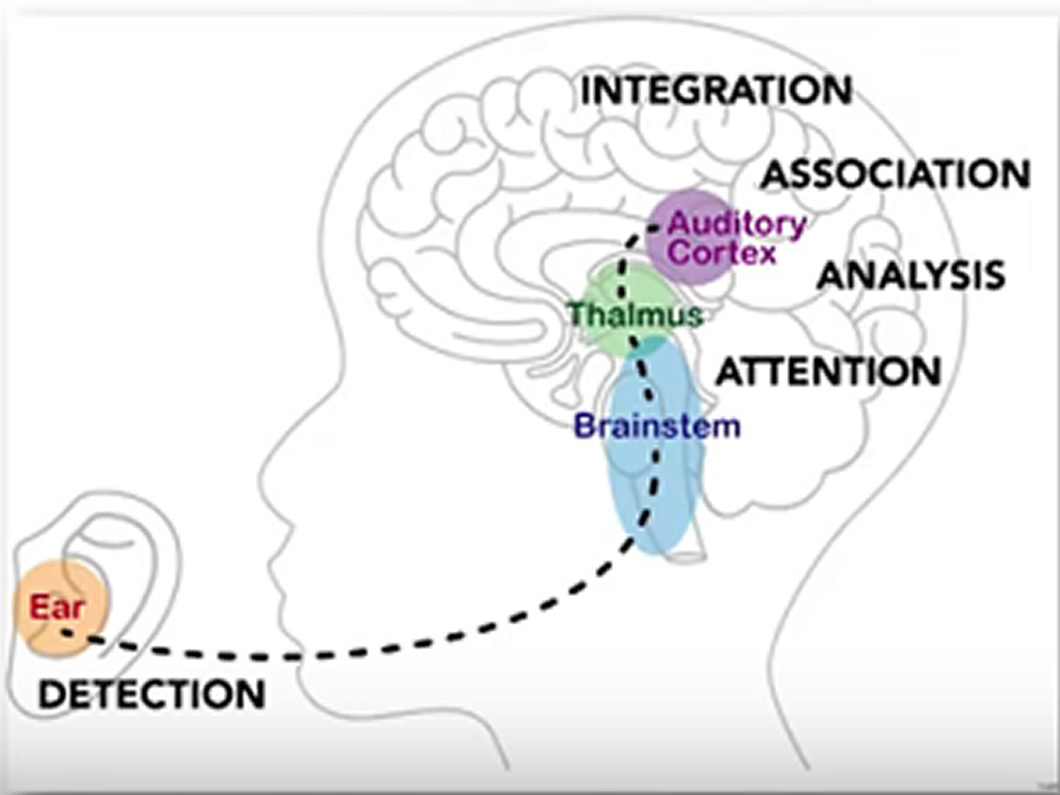 auditory processing disorder in teenager