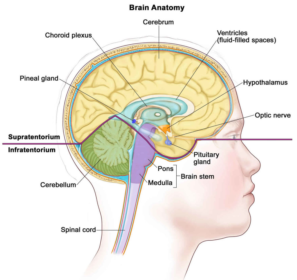 Intracranial germinoma causes, symptoms, diagnosis, treatment & prognosis