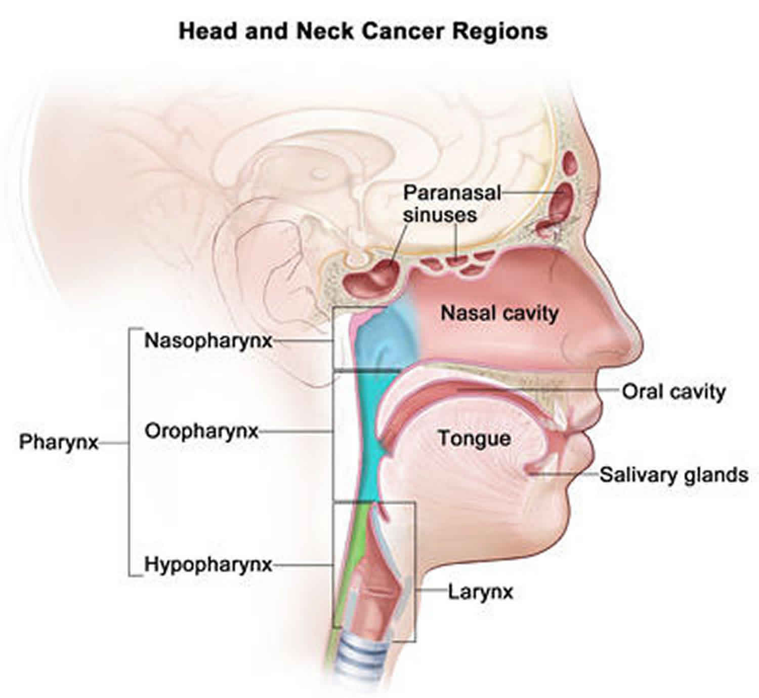 Head And Neck Cancer Types Causes Symptoms Diagnosis Treatment 