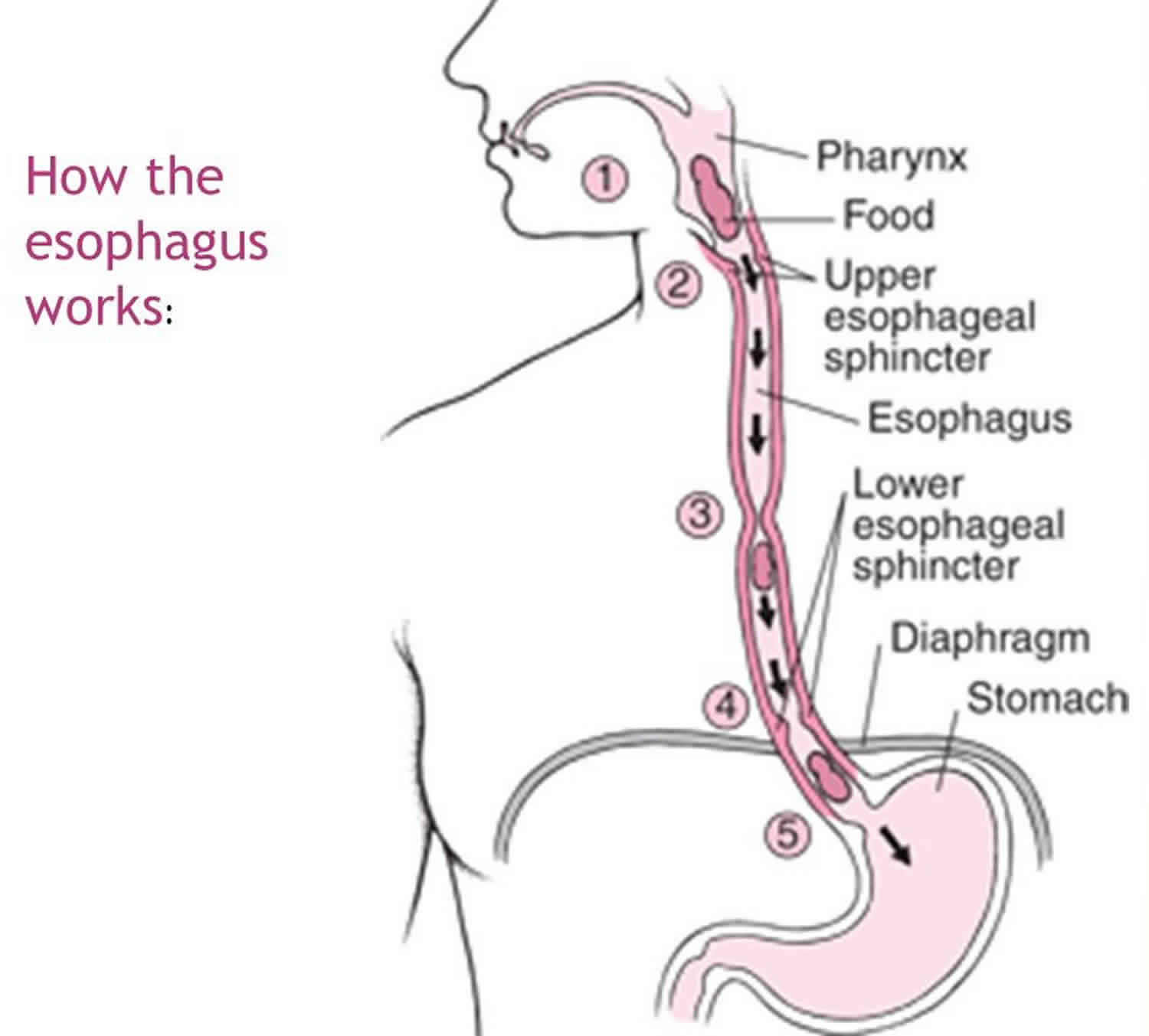 esophageal-dysmotility