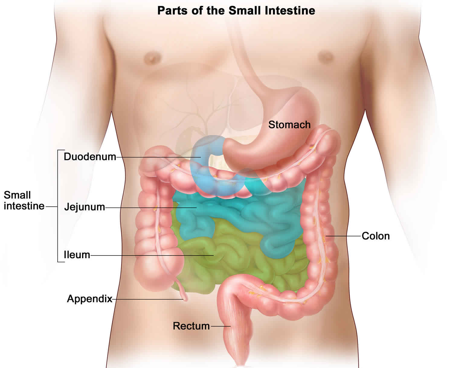 ileitis-causes-symptoms-diagnosis-treatment