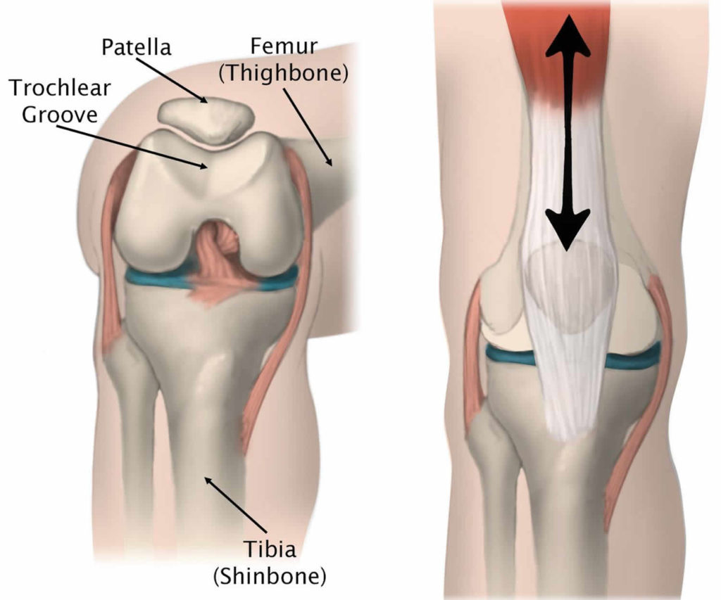 Patellar dislocation causes, symptoms, diagnosis, treatment & prognosis