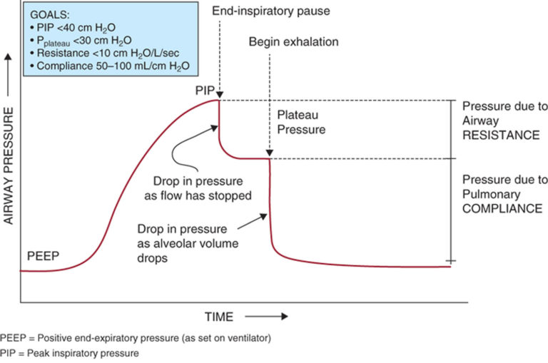 Peak airway pressure in mechanical ventilation definition & interpretation