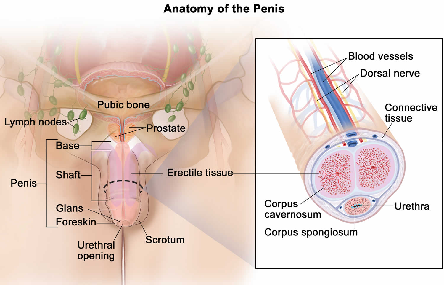 Man's Penis Is Turning To Bone