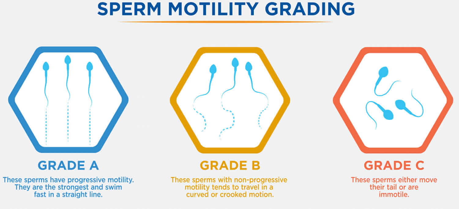 Motility Range Chart