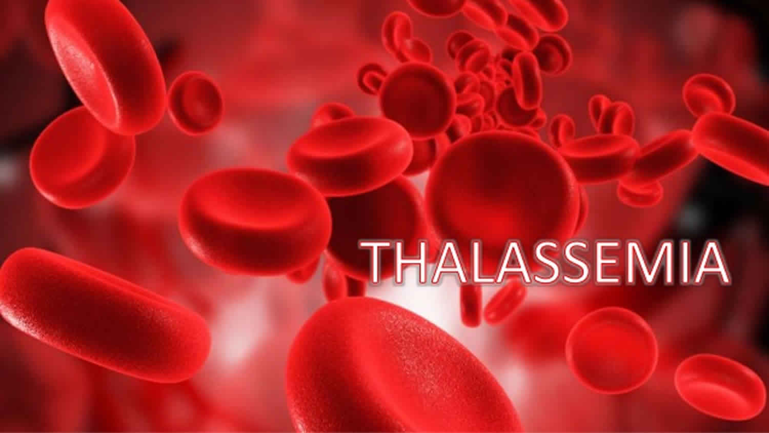 thalassemia intermedia