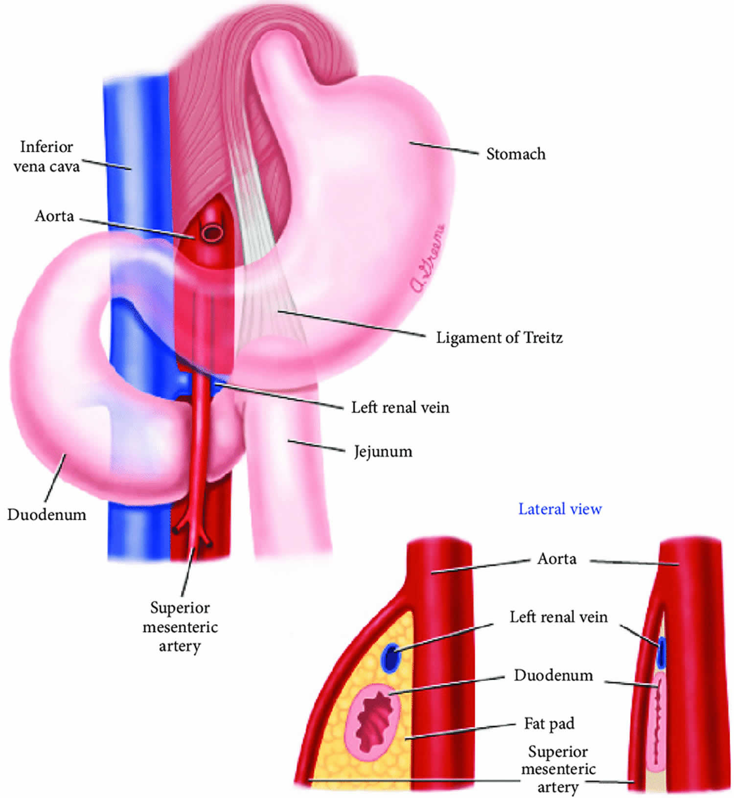 SMA Syndrome Causes Symptoms Diagnosis Treatment Prognosis