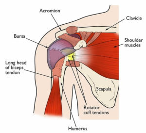 Sulcus sign shoulder, sulcus sign test & positive sulcus sign treatment