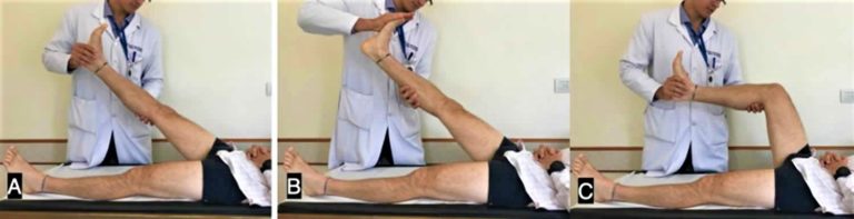 straight leg raise test for sciatica
