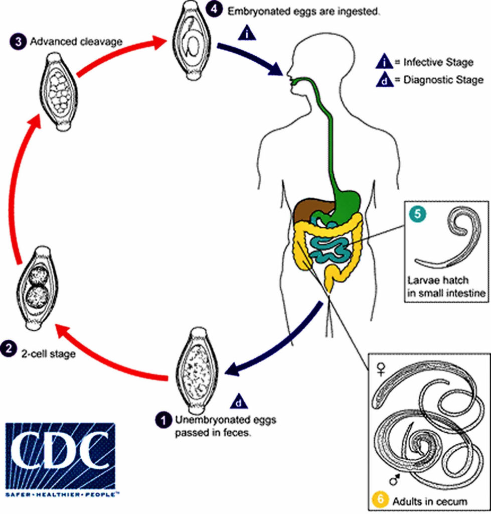 Trichuris trichiura infection, transmission, lifee cycle, symptoms ...