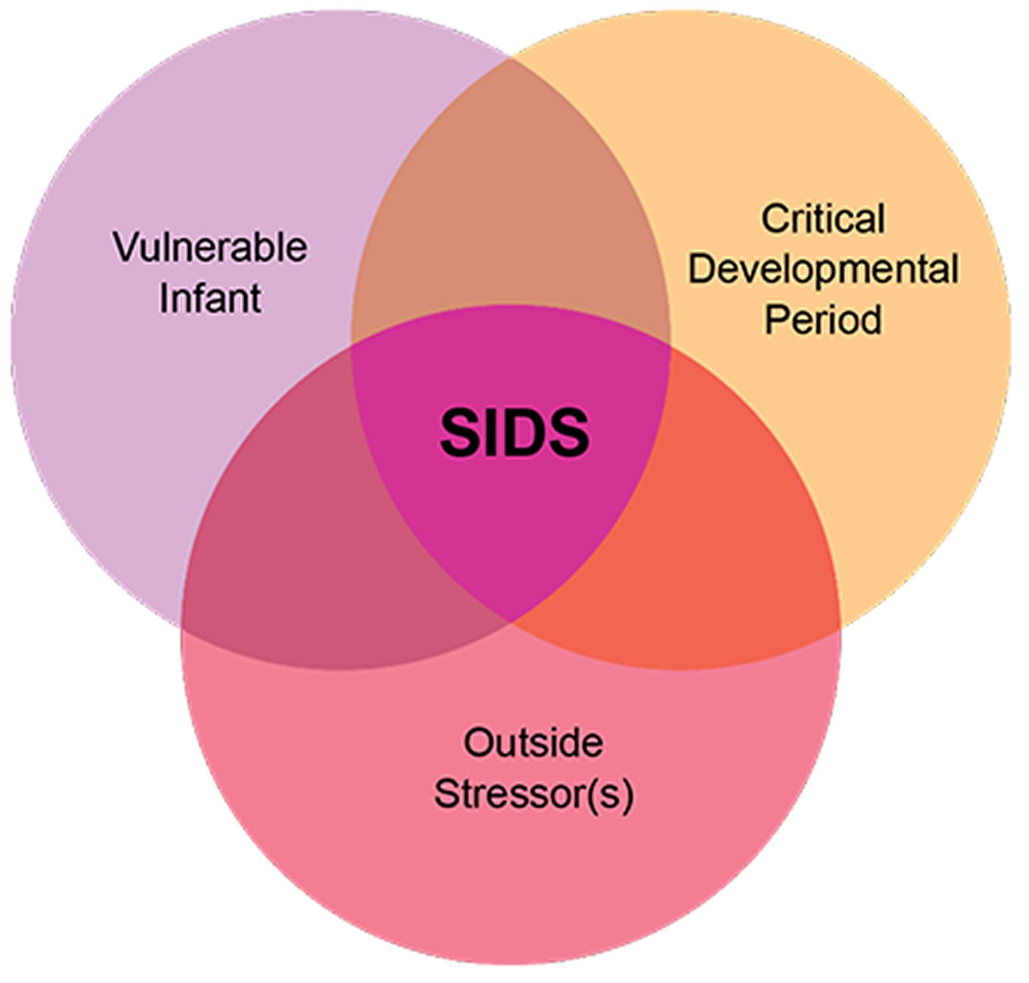 Triple-Risk Model for SIDS
