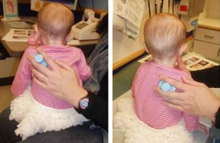 Chest physiotherapy technique