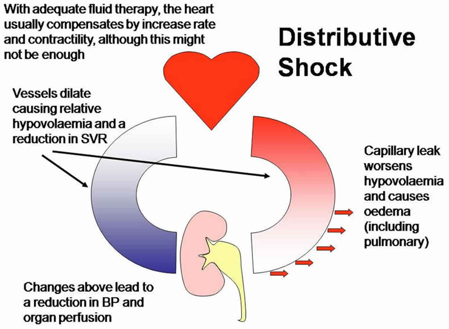 distributive-shock-definition-causes-symptoms-diagnosis-treatment