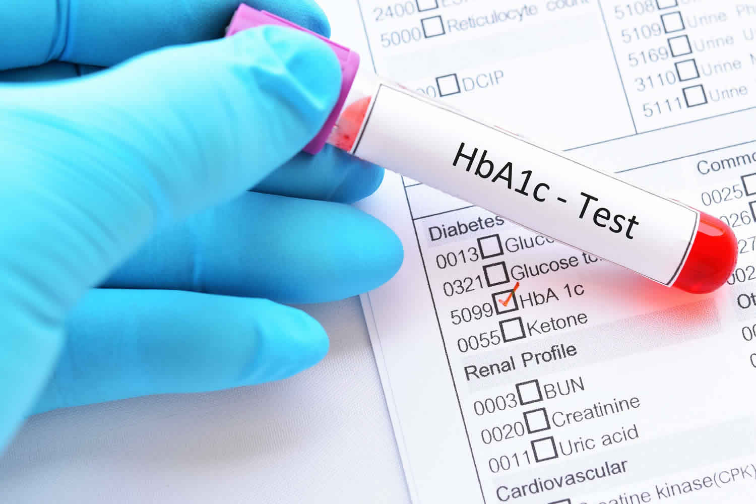 Glycosylated Hemoglobin Or Glycosylated Hemoglobin A1c Test Range