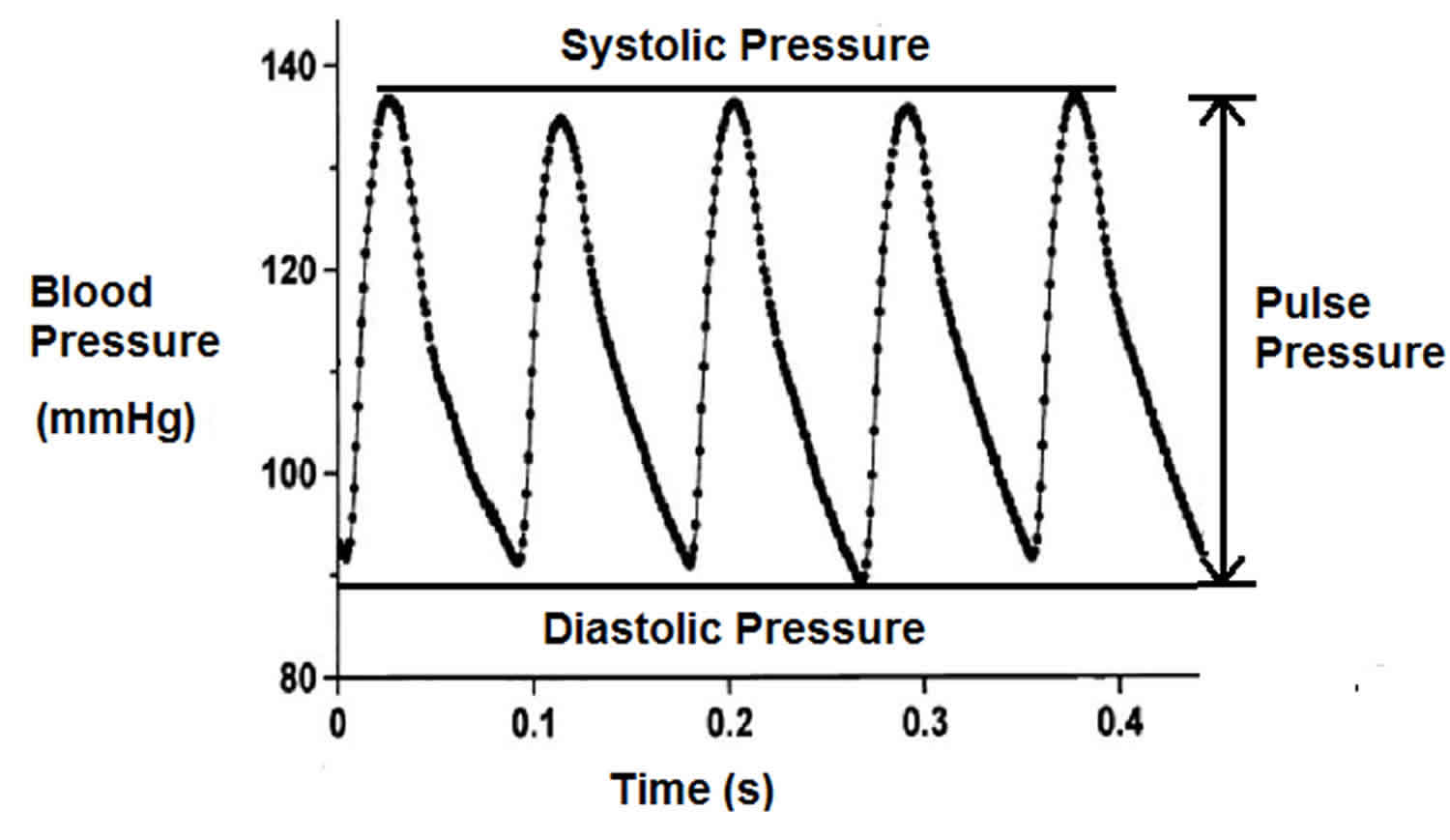 Narrowing shop pulse pressure