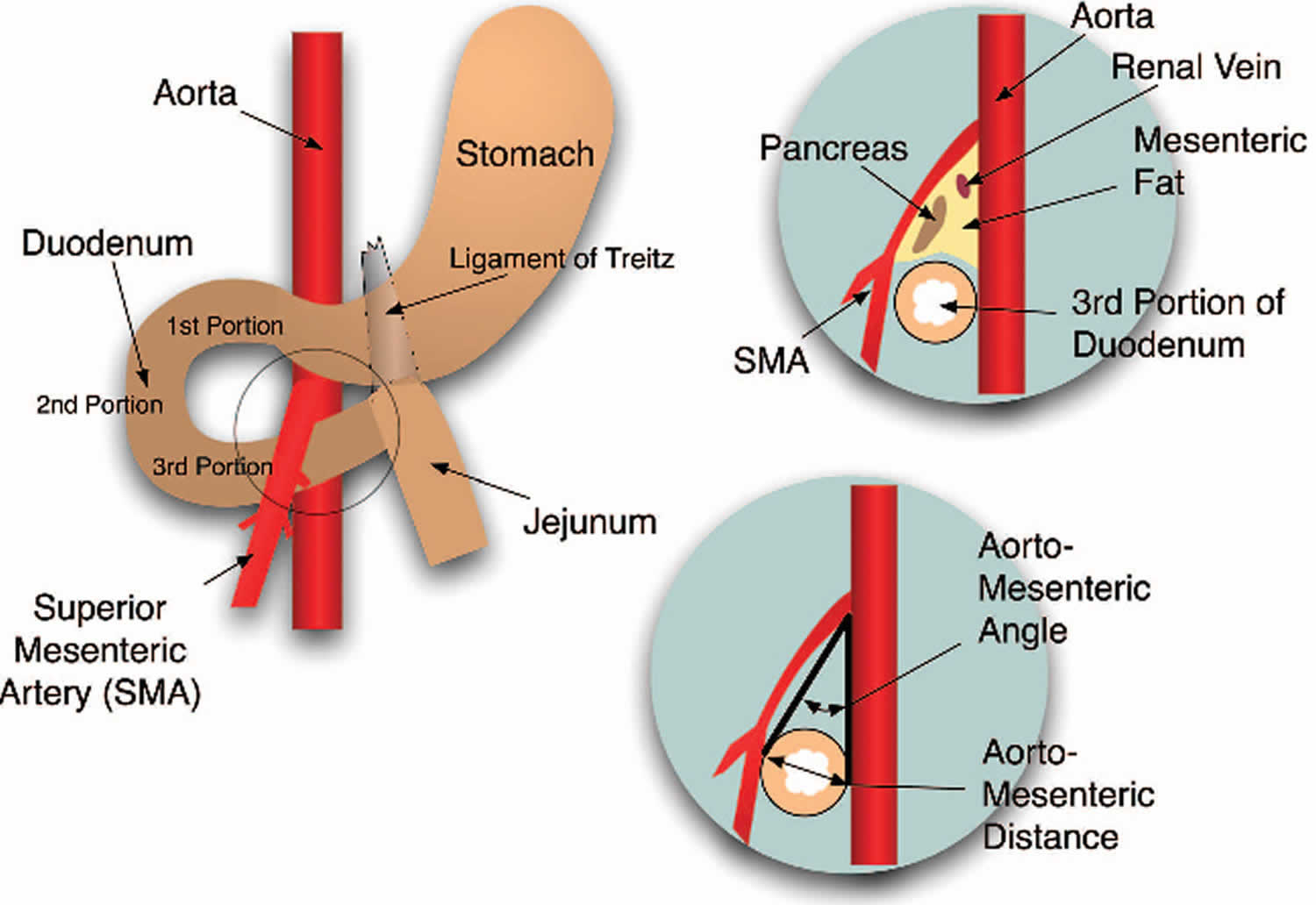 SMA Syndrome Causes Symptoms Diagnosis Treatment Prognosis
