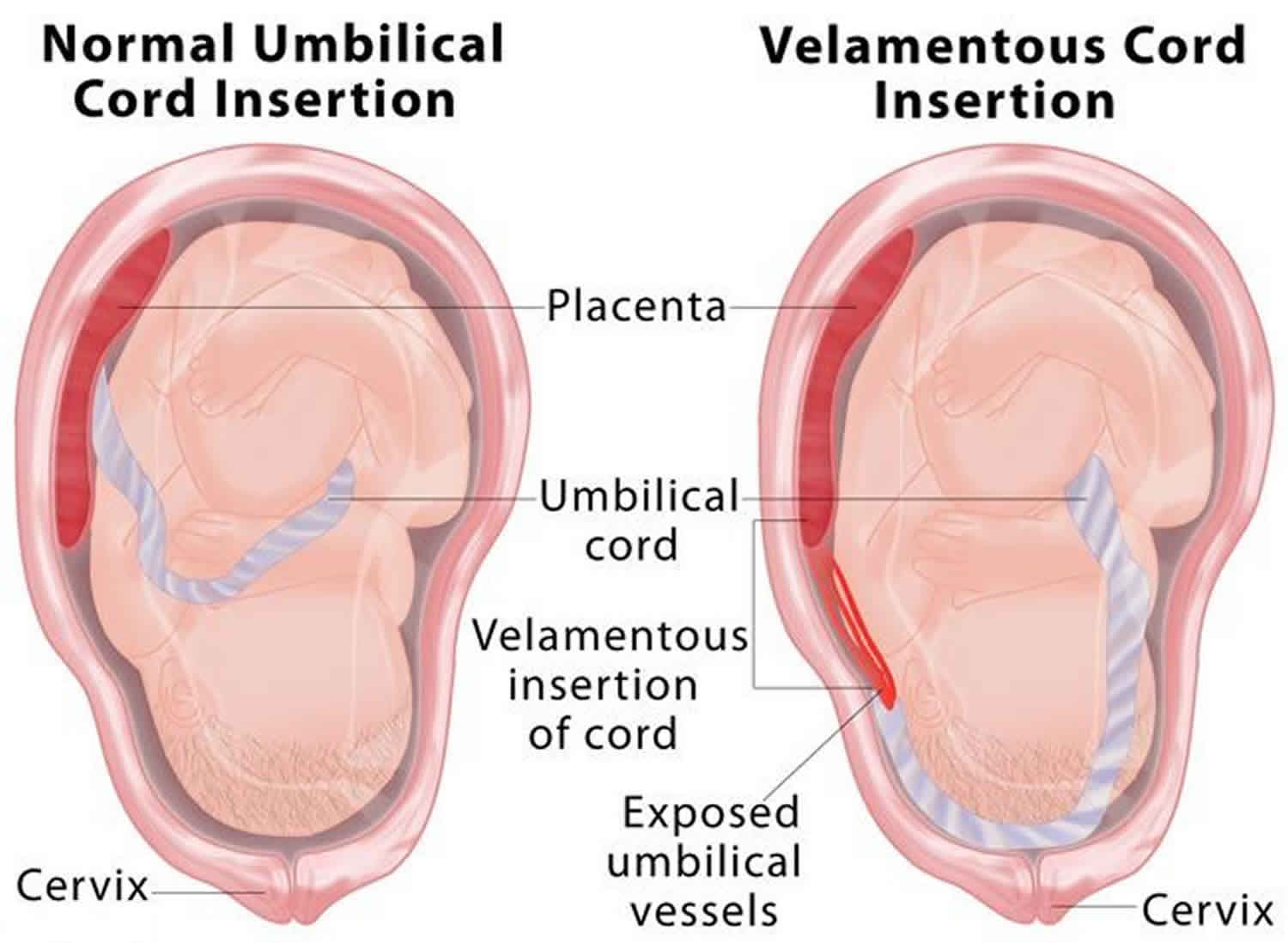 presentation of the cord definition