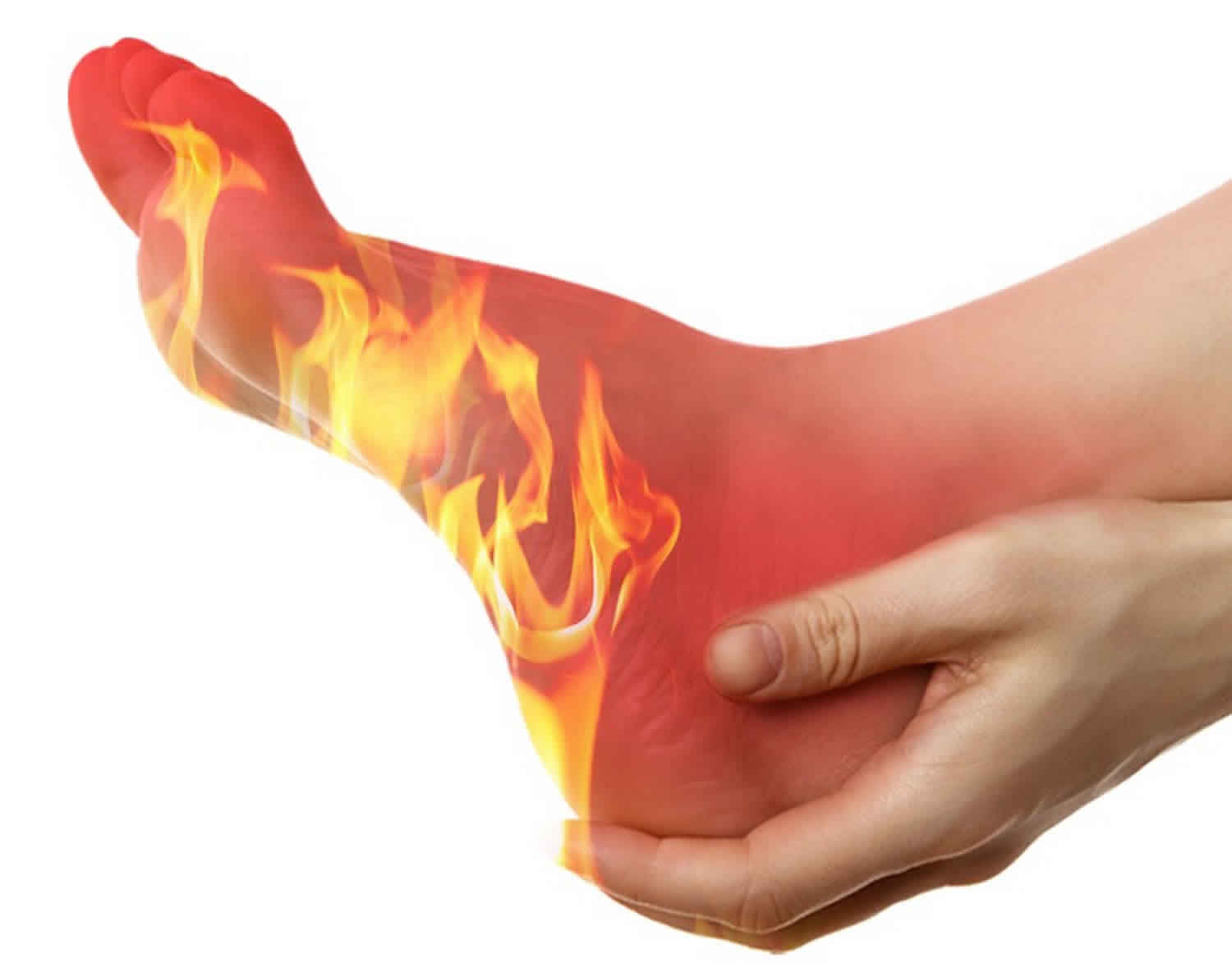 Burning Feet Syndrome Causes Symptoms Diagnosis Treatment