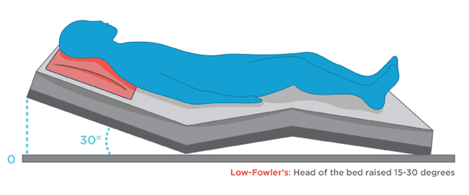 What Is Low Fowler S Position