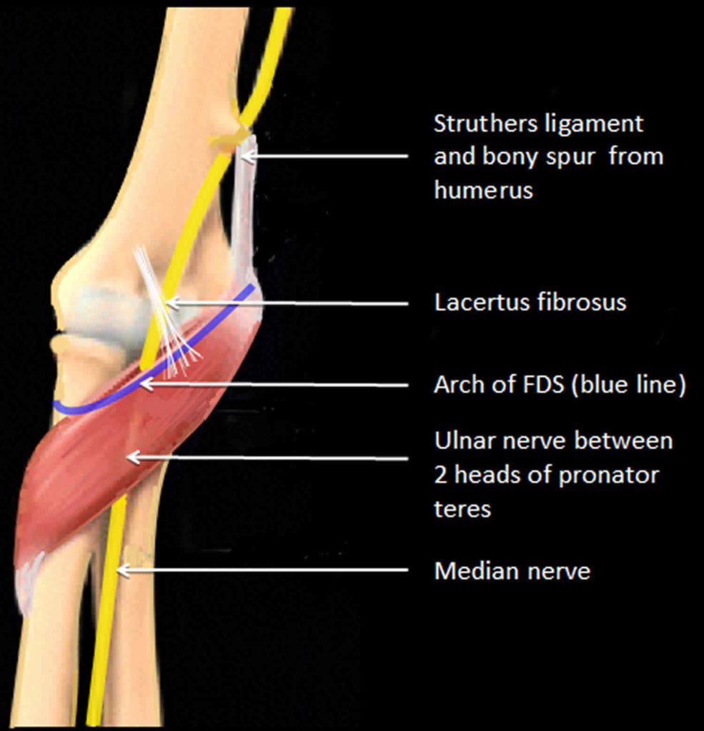 Pronator teres syndrome causes, symptoms, diagnosis, treatment & prognosis