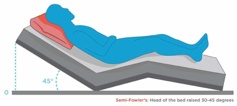 fowler-s-position-uses-for-fowler-s-position