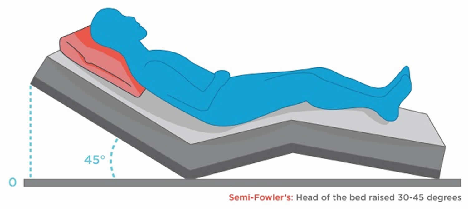 Semi Fowler's position