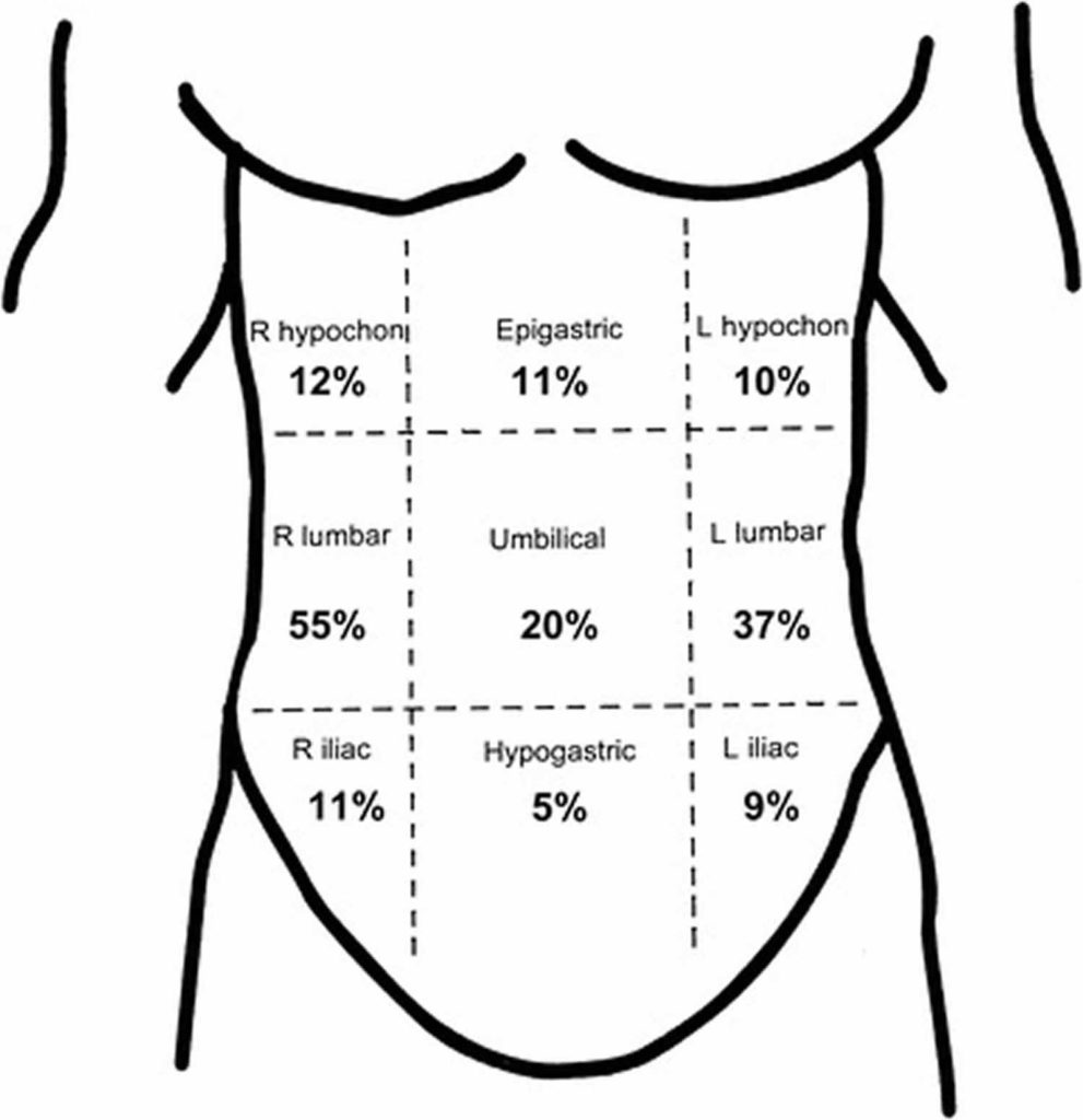 Side Stitch Causes Symptoms Side Stitch Treatment side-stitch-causes-symptoms-side-stitch-treatment