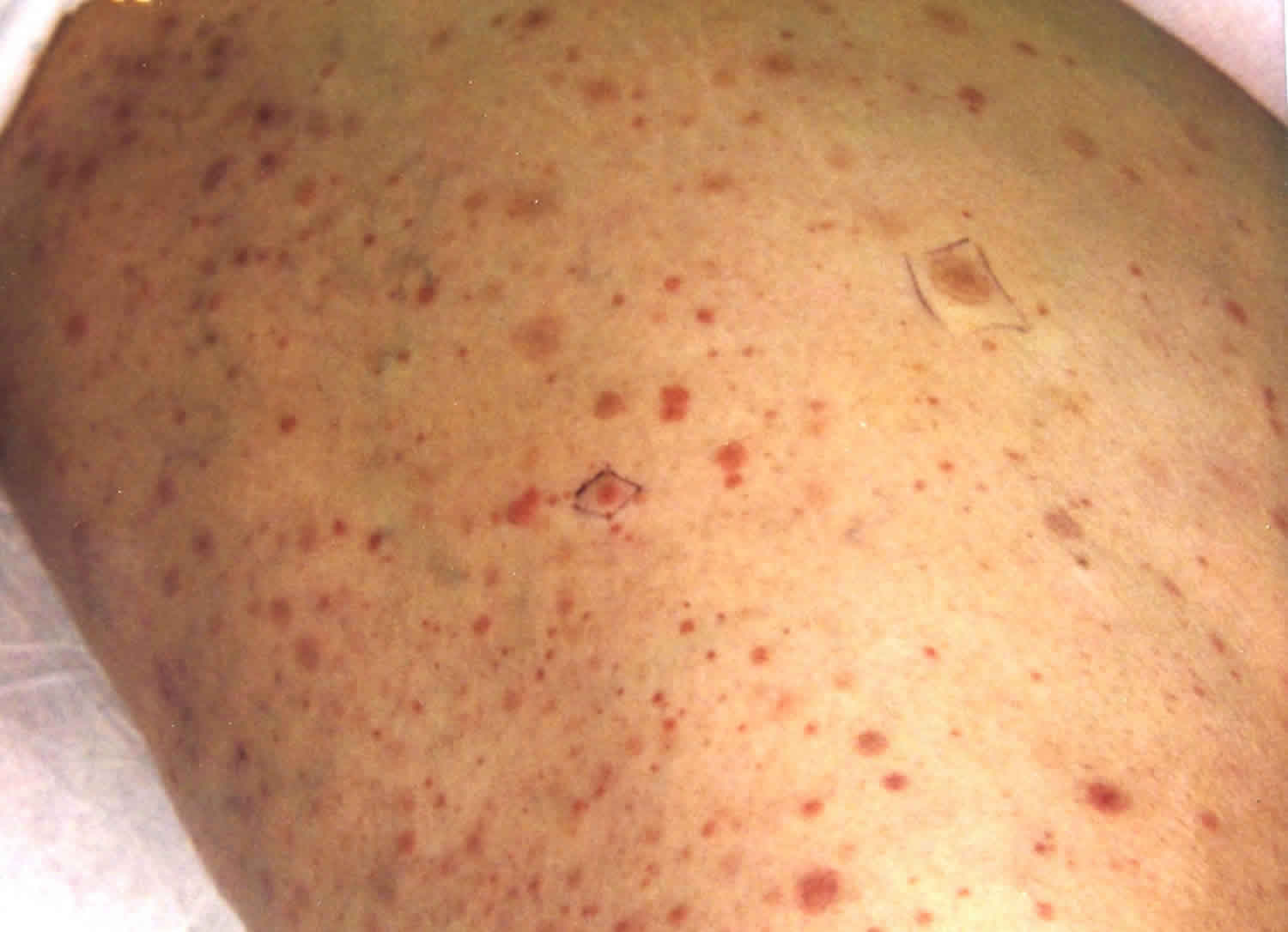 pinpoint red spots on skin